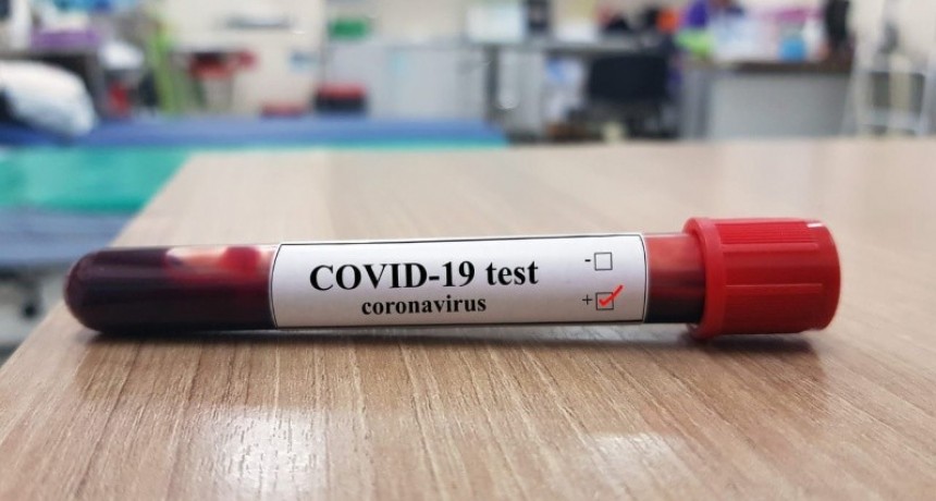 Coronavirus: Falleció un hombre de 70 años