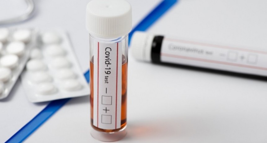 Coronavirus: se confirmaron 32 contagios más 