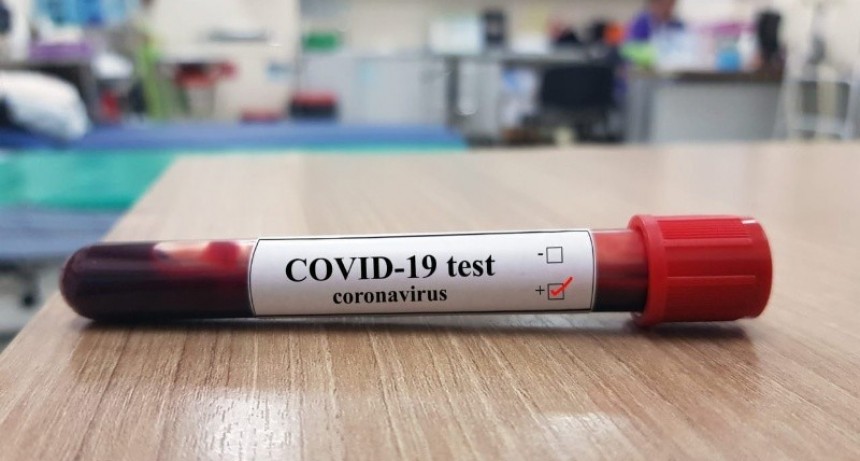 COVID-19: otros 27 infectados 