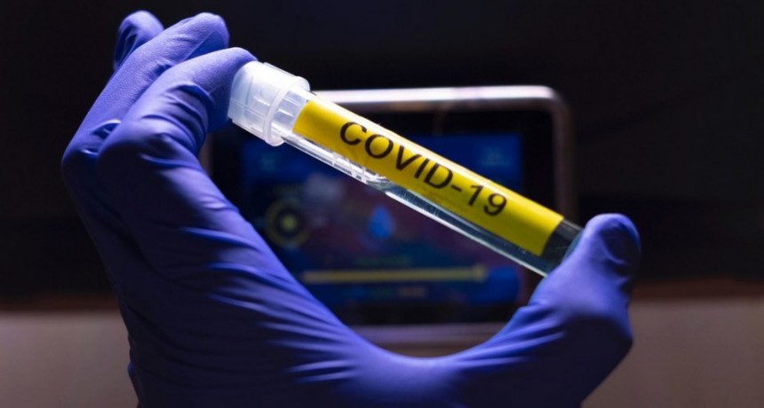 COVID-19: un fallecido, 29 infectados y 47 recuperados 