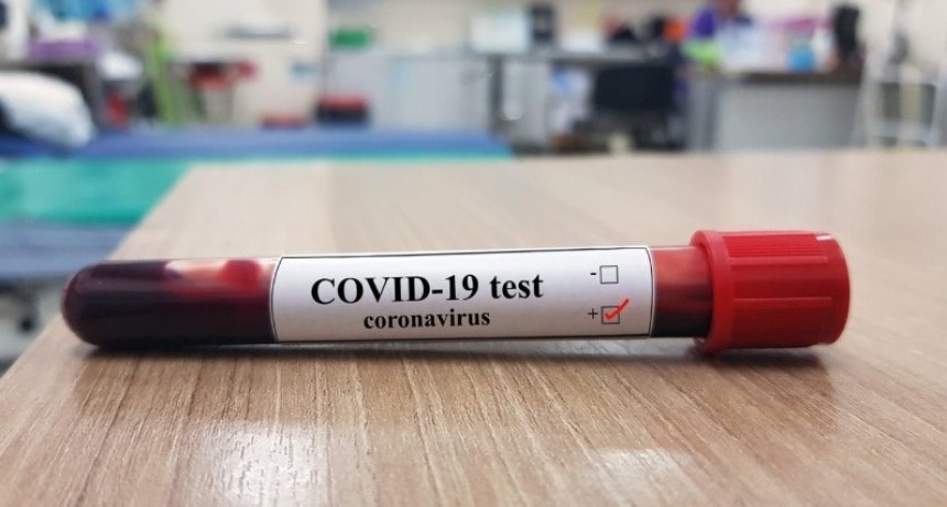 COVID-19: un fallecido y 18 infectados 